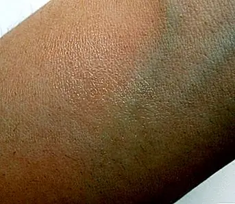 Это масло из ассортимента «Блаженных» продуктов «Спа мира», вероятно, наиболее подходит для массажа пара! Или что-то для лечения вашего партнера! Это масло из ассортимента «Блаженных» продуктов «Спа мира», вероятно, наиболее подходит для массажа пара! Или что-то для лечения вашего партнера!