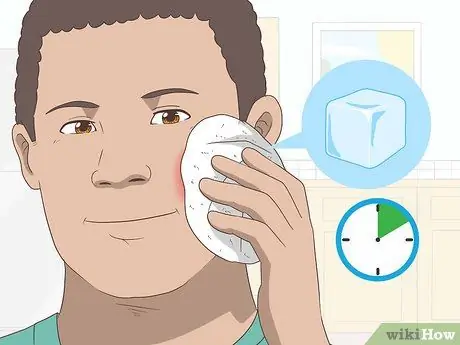 Уменьшить опухание укусов насекомых Шаг 4