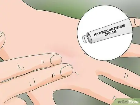 Лечить укус гусеницы Шаг 5