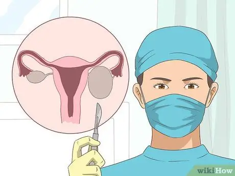 Уменьшение кисты яичника Шаг 8