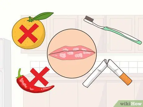 Вылечить красный плоский лишай, шаг 4 Вылечить красный плоский лишай, шаг 4