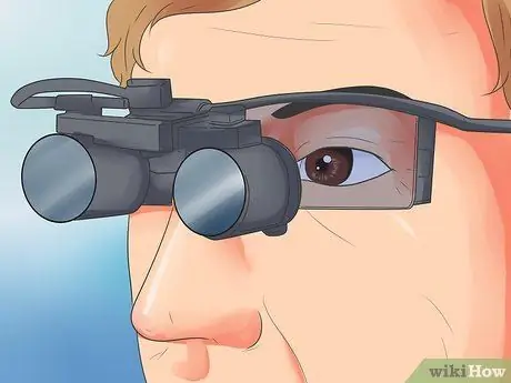 Rehab Vision Post Stroke Step 11 Rehab Vision Post Stroke Step 11
