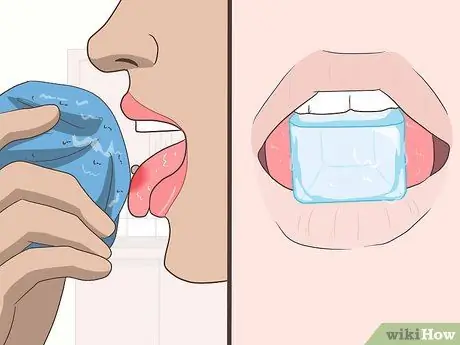 Уменьшить отек языка Шаг 10