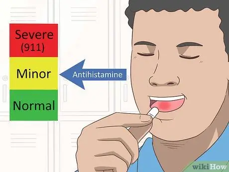 Уменьшить отек языка Шаг 3
