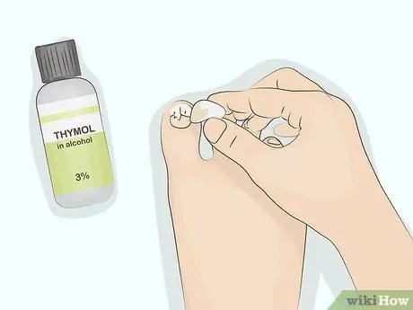 Лечение онихолиза Шаг 10