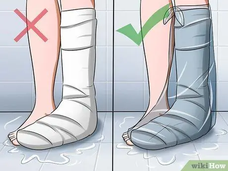Исцелить сломанные кости, шаг 6