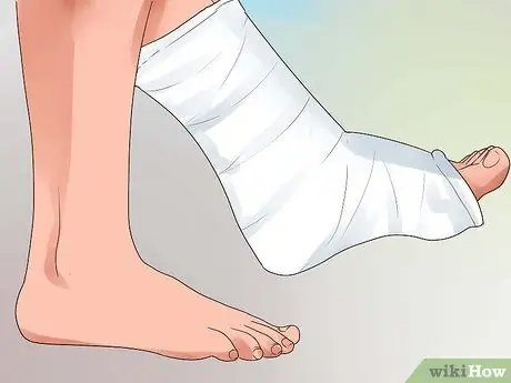 Вылечить сломанный палец ноги Шаг 10
