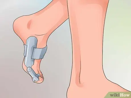 Вылечить сломанный палец ноги Шаг 9