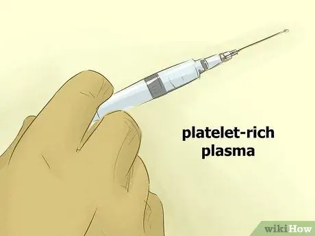 Избавьтесь от растяжек Шаг 10