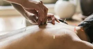 Акупунктура у младенцев и детей улучшает сон и колики