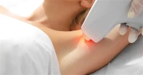 Больно ли делать лазерную эпиляцию? Посмотрите, как это делается и сколько это стоит