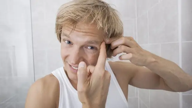 Выдавливание прыщей Выдавливание прыщей