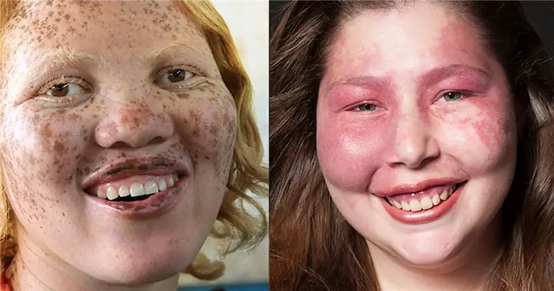 'Эти дети великолепны': 'On Beauty' фильм фокусируется на различиях