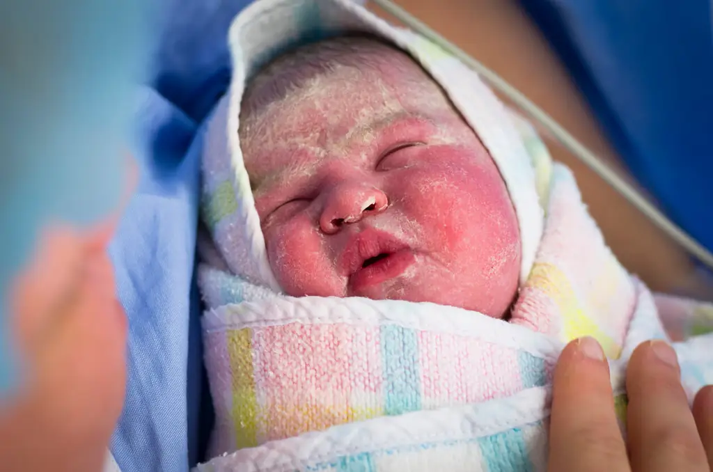 vernix caseosa новорожденных защита кожи новорожденных одеяла роды