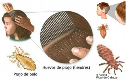 ebc01a2eae81483f671d2f5b57a2442d ebc01a2eae81483f671d2f5b57a2442d