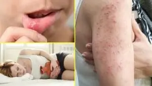 непереносимость пшеницы непереносимость пшеницы