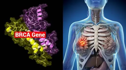 Исследователи объясняют, как ген BRCA увеличивает риск рака молочной железы