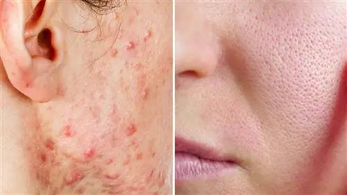 Наука объясняет 5 вещей, которые люди делают для здоровой кожи, но которые на самом деле не работают