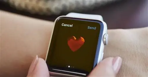 Женщина узнает, что беременна, потому что ее Apple Watch предупреждают ее