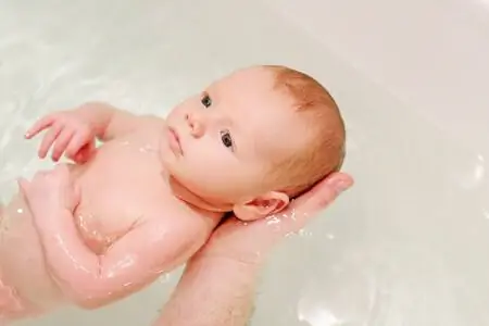 Семь специальных шампуней для лечения колыбели у младенцев