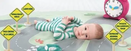 СМА-симптомы СМА-симптомы
