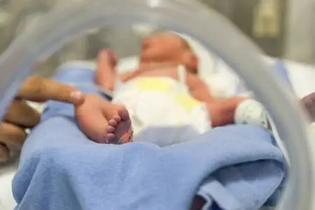 Лучшие советы для родителей недоношенных детей