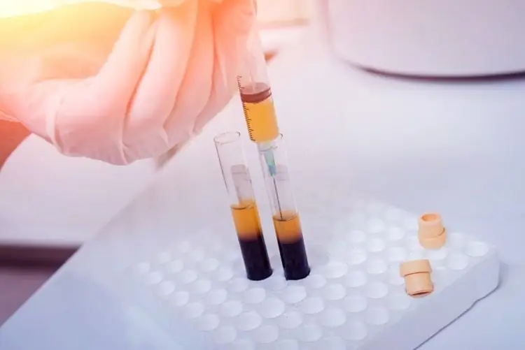 Исследование коронавируса Coviplasm: новая надежда