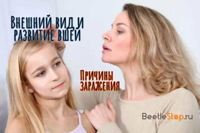Вам стыдно, что у вашего ребенка вши?